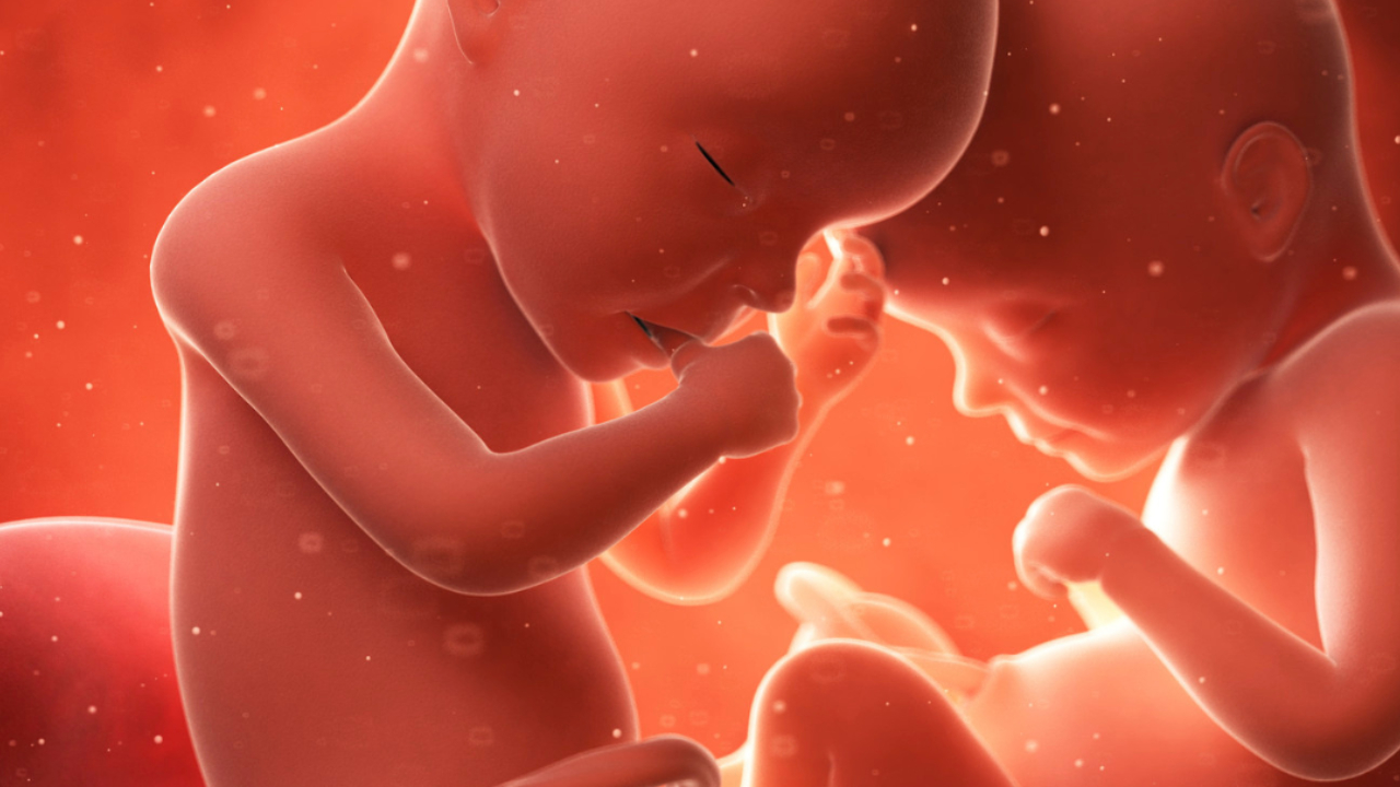 Et si tu n’avais jamais été seule ? Le syndrome du jumeau perdu et son lien avec l’infertilité. 1 Jumeaux